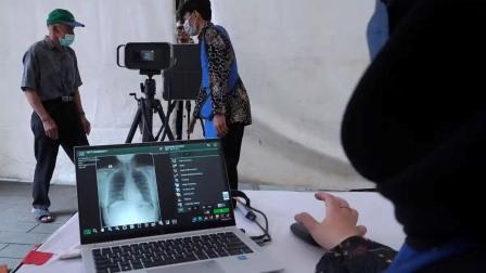Kemenkes Tambah Anggaran Khusus untuk Percepatan Deteksi TBC pada 2026